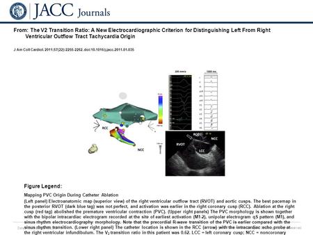 Date of download: 6/18/2016 Copyright © The American College of Cardiology. All rights reserved. From: The V2 Transition Ratio: A New Electrocardiographic.