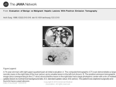 Date of download: 6/20/2016 Copyright © 2016 American Medical Association. All rights reserved. From: Evaluation of Benign vs Malignant Hepatic Lesions.