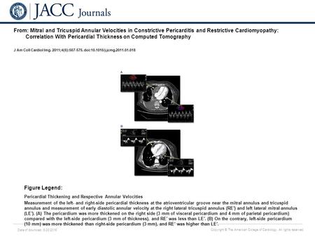 Date of download: 6/20/2016 Copyright © The American College of Cardiology. All rights reserved. From: Mitral and Tricuspid Annular Velocities in Constrictive.