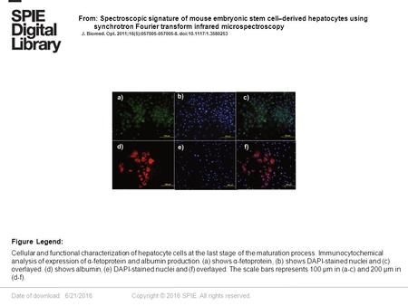 Date of download: 6/21/2016 Copyright © 2016 SPIE. All rights reserved. Cellular and functional characterization of hepatocyte cells at the last stage.