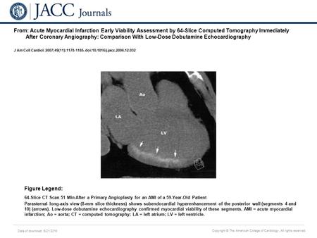 Date of download: 6/21/2016 Copyright © The American College of Cardiology. All rights reserved. From: Acute Myocardial Infarction Early Viability Assessment.