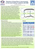 Reaction of blood flow in microvessels on the local heating in patients with DM1 Irina Mizeva, Darya Airikh Institute of continuous media mechanics, Perm,