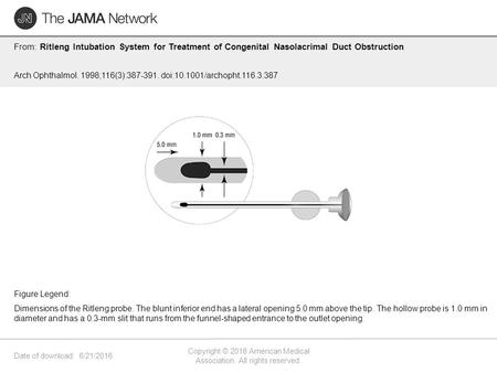 Date of download: 6/21/2016 Copyright © 2016 American Medical Association. All rights reserved. From: Ritleng Intubation System for Treatment of Congenital.