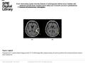 Date of download: 6/21/2016 Copyright © 2016 SPIE. All rights reserved. Example (a) T1 postcontrast image and (b) T2 FLAIR image after preprocessing. An.