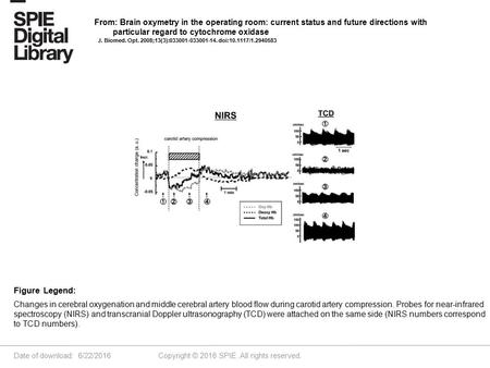 Date of download: 6/22/2016 Copyright © 2016 SPIE. All rights reserved. Changes in cerebral oxygenation and middle cerebral artery blood flow during carotid.