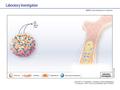 Laboratory Investigation advance online publication 29 January 2007; doi:10.1038/labinvest.3700526 BMDC recruitment in tumors.