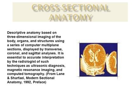 Descriptive anatomy based on three-dimensional imaging of the body, organs, and structures using a series of computer multiplane sections, displayed by.