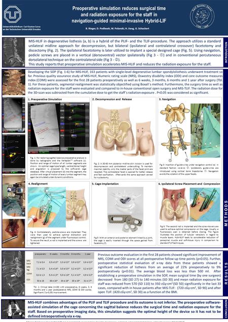 Universitätsklinikum Carl Gustav Carus an der Technischen Universität Dresden Preoperative simulation reduces surgical time and radiation exposure for.