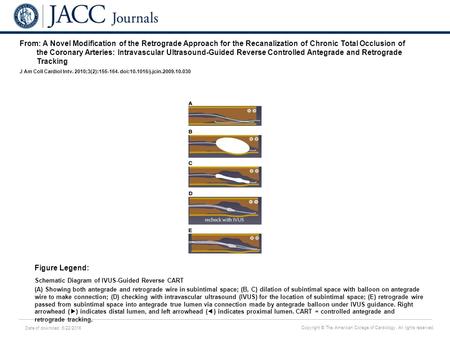 Date of download: 6/22/2016 Copyright © The American College of Cardiology. All rights reserved. From: A Novel Modification of the Retrograde Approach.