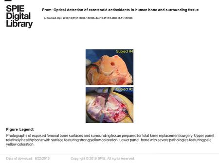 Date of download: 6/22/2016 Copyright © 2016 SPIE. All rights reserved. Photographs of exposed femoral bone surfaces and surrounding tissue prepared for.