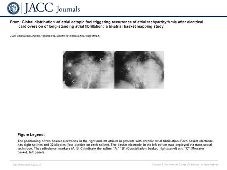 Date of download: 6/22/2016 Copyright © The American College of Cardiology. All rights reserved. From: Global distribution of atrial ectopic foci triggering.