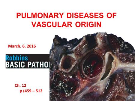 March. 6. 2016 Ch. 12 p (459 – 512 PULMONARY DISEASES OF VASCULAR ORIGIN.