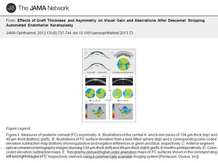 Date of download: 6/22/2016 Copyright © 2016 American Medical Association. All rights reserved. From: Effects of Graft Thickness and Asymmetry on Visual.