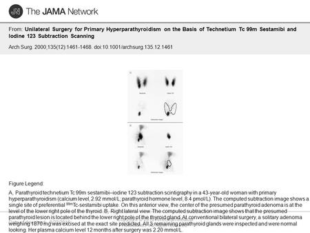 Date of download: 6/22/2016 Copyright © 2016 American Medical Association. All rights reserved. From: Unilateral Surgery for Primary Hyperparathyroidism.