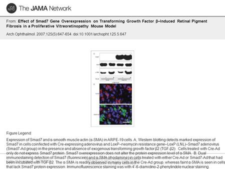 Date of download: 6/23/2016 Copyright © 2016 American Medical Association. All rights reserved. From: Effect of Smad7 Gene Overexpression on Transforming.