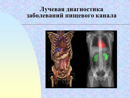 Лучевая диагностика заболеваний пищевого канала