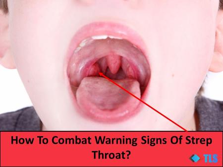 How To Combat Warning Signs Of Strep Throat?