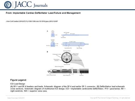 Date of download: 6/23/2016 Copyright © The American College of Cardiology. All rights reserved. From: Implantable Cardiac Defibrillator Lead Failure and.