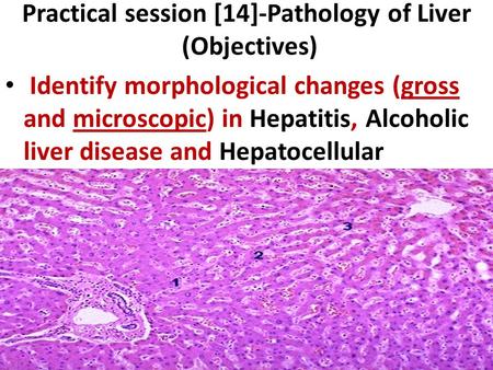 Practical session [14]-Pathology of Liver (Objectives)