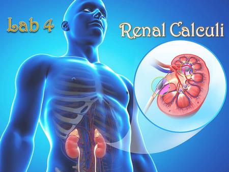 Lab 4 Renal Calculi.