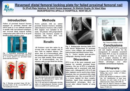 Www.postersession.com Failure of proximal femoral fracture managed by proximal femoral nail (PFN) leads to a very difficult situation to handle with conventional.