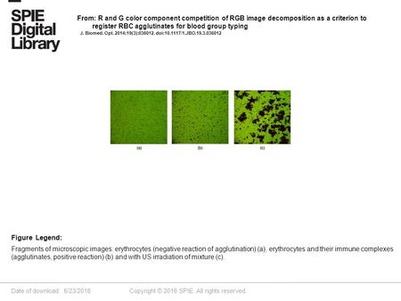 Date of download: 6/23/2016 Copyright © 2016 SPIE. All rights reserved. Fragments of microscopic images: erythrocytes (negative reaction of agglutination)