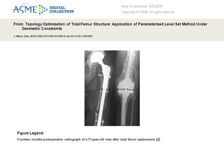 Date of download: 6/23/2016 Copyright © ASME. All rights reserved. From: Topology Optimization of Total Femur Structure: Application of Parameterized Level.