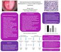 Hydroxychloroquine-linked lymphoma development in a mouse model of Sjogren’s Syndrome Morgan Adams Department of Biological Sciences, York College of Pennsylvania.