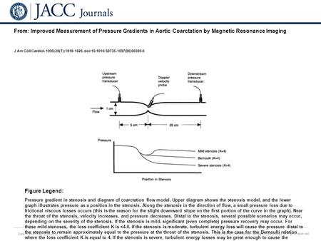 Date of download: 6/24/2016 Copyright © The American College of Cardiology. All rights reserved. From: Improved Measurement of Pressure Gradients in Aortic.