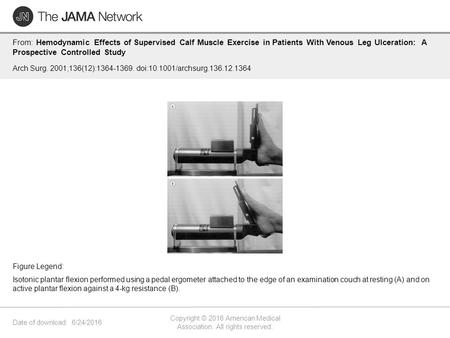 Date of download: 6/24/2016 Copyright © 2016 American Medical Association. All rights reserved. From: Hemodynamic Effects of Supervised Calf Muscle Exercise.