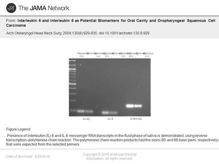 Date of download: 6/24/2016 Copyright © 2016 American Medical Association. All rights reserved. From: Interleukin 6 and Interleukin 8 as Potential Biomarkers.