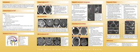 IntroductionClassic signs on CTMagnetic resonance venographyDiagnostic Pitfalls Dural sinus thrombosis (DST) is an uncommon but potentially devastating.