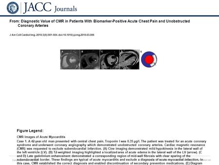 Date of download: 6/24/2016 Copyright © The American College of Cardiology. All rights reserved. From: Diagnostic Value of CMR in Patients With Biomarker-Positive.