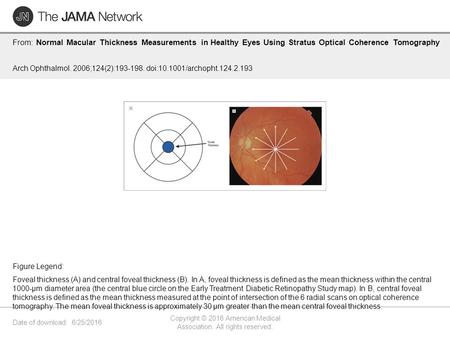 Date of download: 6/25/2016 Copyright © 2016 American Medical Association. All rights reserved. From: Normal Macular Thickness Measurements in Healthy.