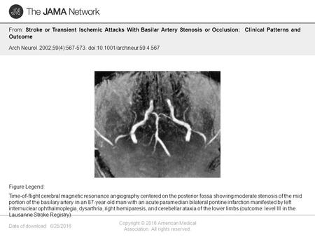 Date of download: 6/25/2016 Copyright © 2016 American Medical Association. All rights reserved. From: Stroke or Transient Ischemic Attacks With Basilar.