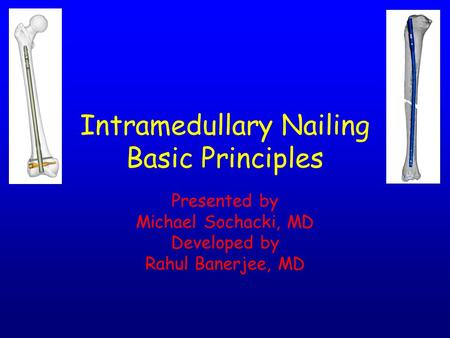 Intramedullary Nailing Basic Principles