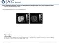 Date of download: 6/25/2016 Copyright © The American College of Cardiology. All rights reserved. From: Increased Extracellular Volume and Altered Mechanics.