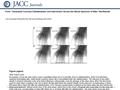 Date of download: 6/25/2016 Copyright © The American College of Cardiology. All rights reserved. From: Transradial Coronary Catheterization and Intervention.