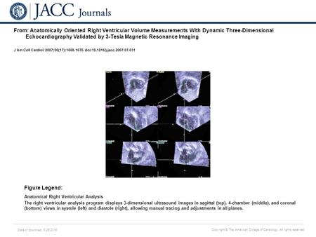 Date of download: 6/25/2016 Copyright © The American College of Cardiology. All rights reserved. From: Anatomically Oriented Right Ventricular Volume Measurements.