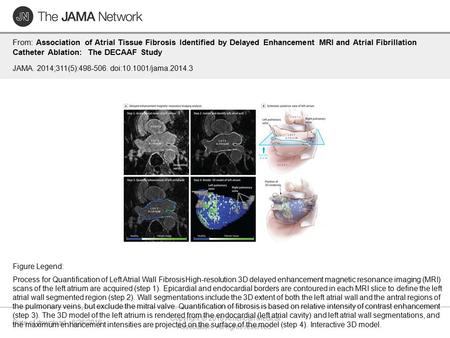 Date of download: 6/26/2016 Copyright © 2016 American Medical Association. All rights reserved. From: Association of Atrial Tissue Fibrosis Identified.