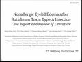 Nonallergic Eyelid Edema After Botulinum Toxin Type A Injection Case Report and Review of Literature Chao-Ming Wu 1, Yin-Shuo Chang 1, 2, Chang-Cheng Chang.