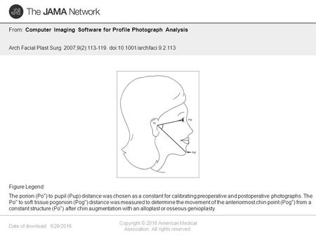 Date of download: 6/26/2016 Copyright © 2016 American Medical Association. All rights reserved. From: Computer Imaging Software for Profile Photograph.