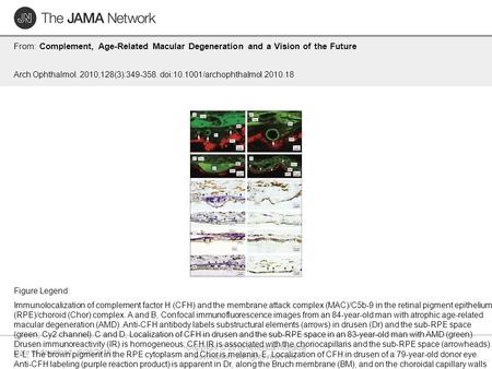 Date of download: 6/26/2016 Copyright © 2016 American Medical Association. All rights reserved. From: Complement, Age-Related Macular Degeneration and.