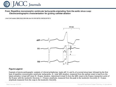 Date of download: 6/27/2016 Copyright © The American College of Cardiology. All rights reserved. From: Repetitive monomorphic ventricular tachycardia originating.