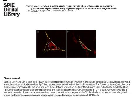 Date of download: 6/27/2016 Copyright © 2016 SPIE. All rights reserved. Sample CP-A and CP-B cells labeled with fluorescent protoporphyrin IX (PpIX) in.