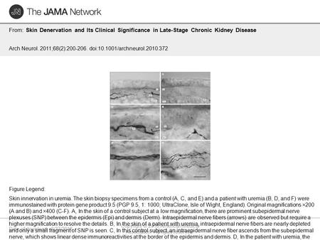 Date of download: 6/27/2016 Copyright © 2016 American Medical Association. All rights reserved. From: Skin Denervation and Its Clinical Significance in.