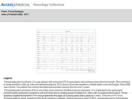 Date of download: 6/27/2016 Copyright © 2016 McGraw-Hill Education. All rights reserved. Panayiotopoulos Syndrome. A 5-year-old girl with nocturnal GTCS.