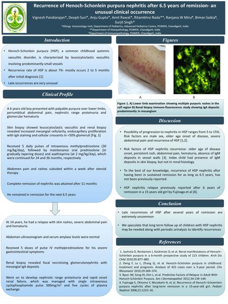 Recurrence of Henoch-Schonlein purpura nephritis after 6.5 years of remission- an unusual clinical occurrence Vignesh Pandiarajan*, Deepti Suri*, Anju.