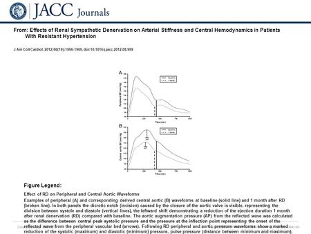 Date of download: 6/27/2016 Copyright © The American College of Cardiology. All rights reserved. From: Effects of Renal Sympathetic Denervation on Arterial.