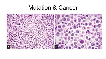 Mutation & Cancer. Tumours & Mitosis Tumours – abnormal groups of cells that develop at any stage of life in any part of the body.